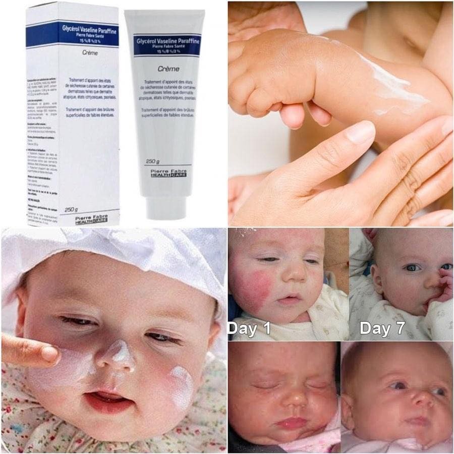 Kem nẻ Glycerol Vaseline Paraffine 250g dùng cho trẻ sơ sinh, nam nữ đều được