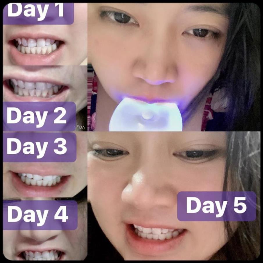 [ Hàng ÚC] Máy làm trắng răng bằng ánh sáng xanh White Glo White Accelerator Blue Light Teeth Whitening System