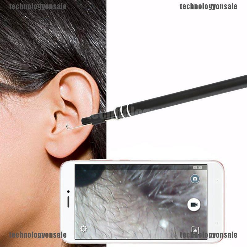 Bộ Dụng Cụ Lấy Ráy Tai Có camera Tiện Lợi Sạc USB