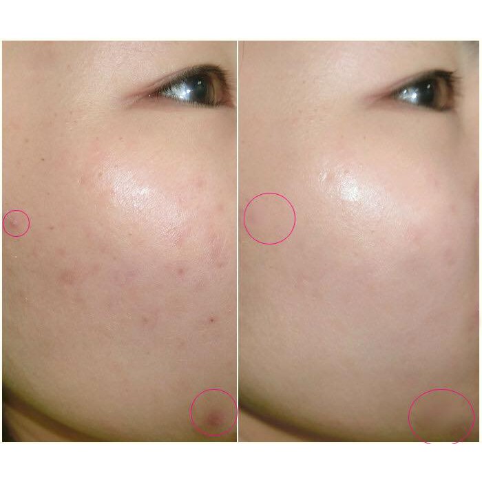 Serum Rohto Melano CC Intensive Anti Spot Essence (20ml) | Shopee Việt Nam