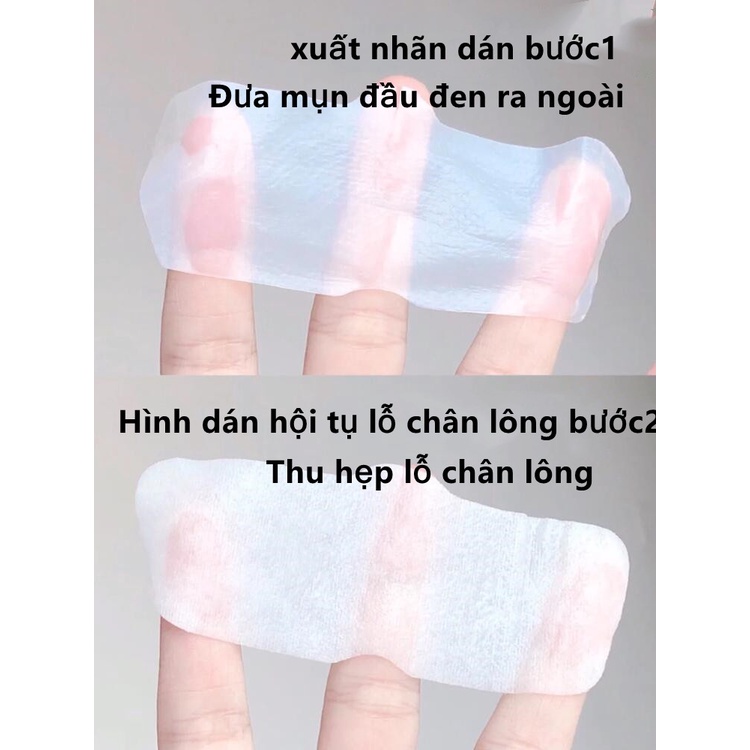 Miếng dán lột mụn đầu đen mũi RNW se khít lỗ chân lông hiệu quả