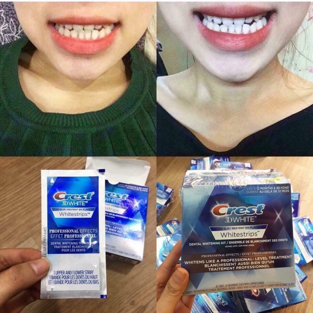 Liệu trình làm trắng sáng răng 3d crest - oralB  [ 14 và 21 miếng ]