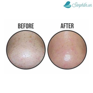 Lột mụn mũi Ciracle Good-Bye Blackhead 100% Cotton