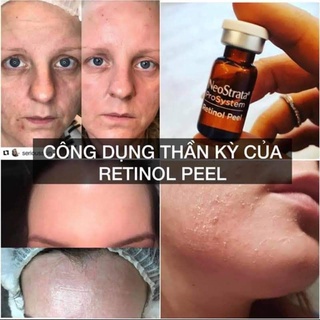 1 lọ Retinol peel Neostrata cho da lão hóa