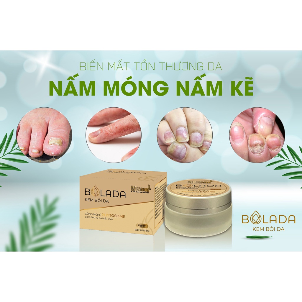 Bolada - 17G - Kem Bôi Da Nấm Ngứa, Hắc Lào, Ghẻ, Viêm Lỗ Chân Lông, Viêm Da Cơ Địa Zona Các Bệnh Ngoài Da BDcare