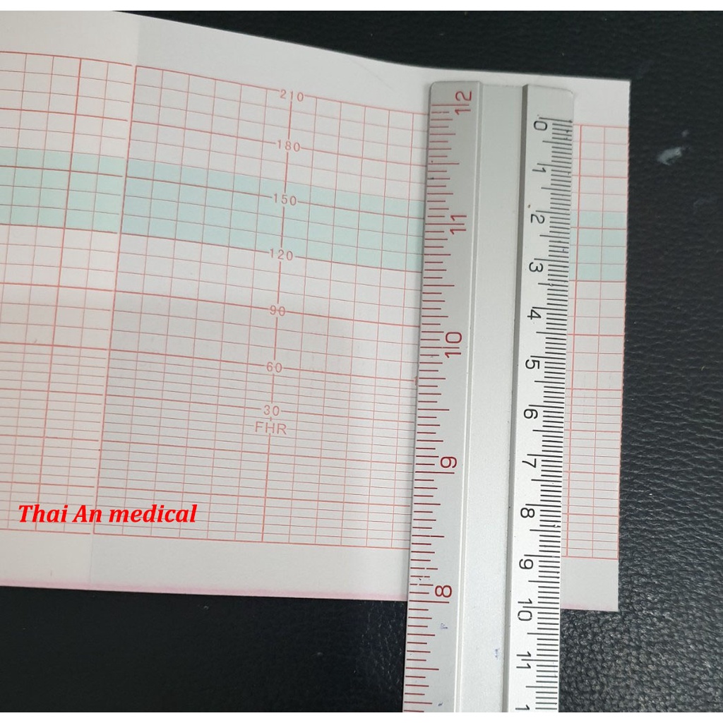 Giấy monitor sản khoa Goldway UT-3000A Edan MFM-800 sọc đỏ 112x100x150