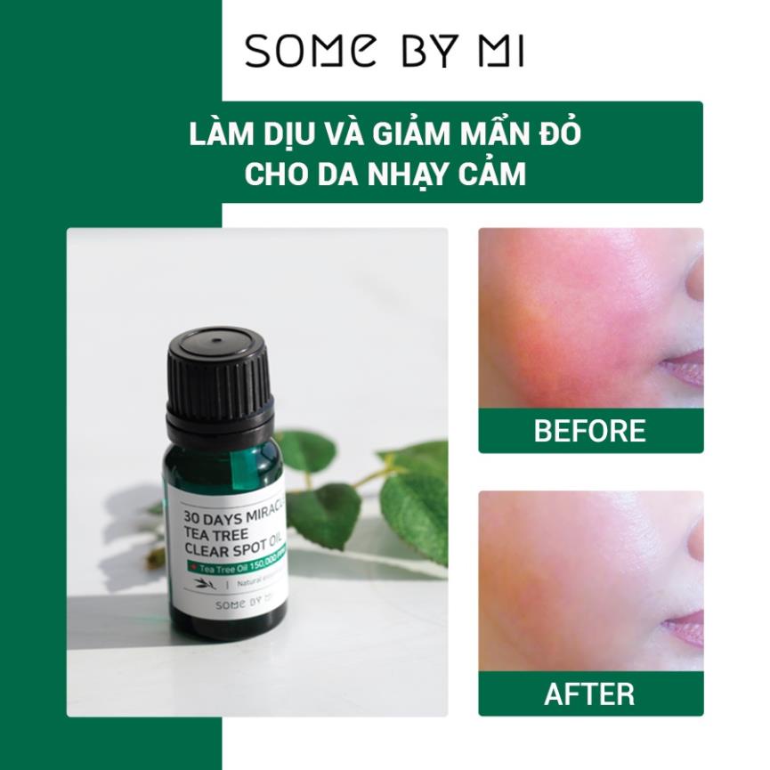 Hàng Công ty Tinh Dầu Tràm Trà Thần Kỳ Some By Mi 30 Days Miracle Tea Tree Clear Spot Oil 10ml