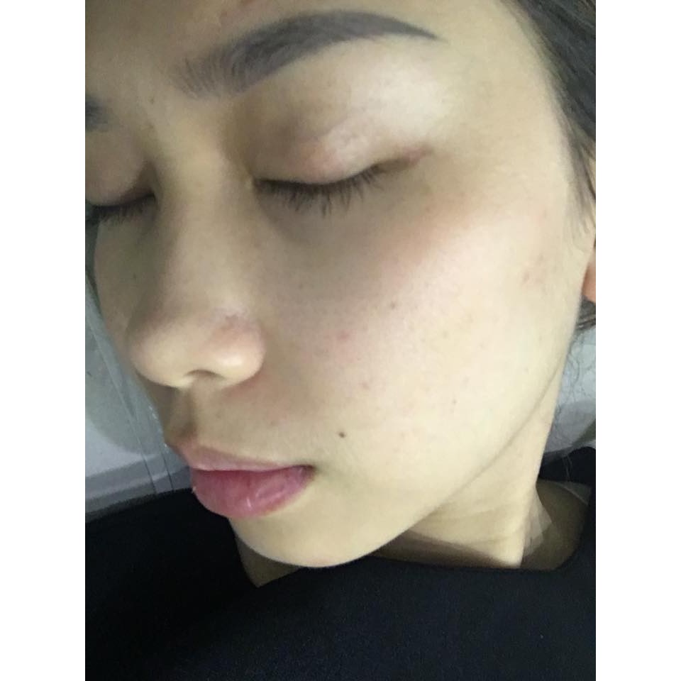 [MẪU MỚI] Blackmores Vitamin E Cream kem dưỡng da 50g | BigBuy360 - bigbuy360.vn