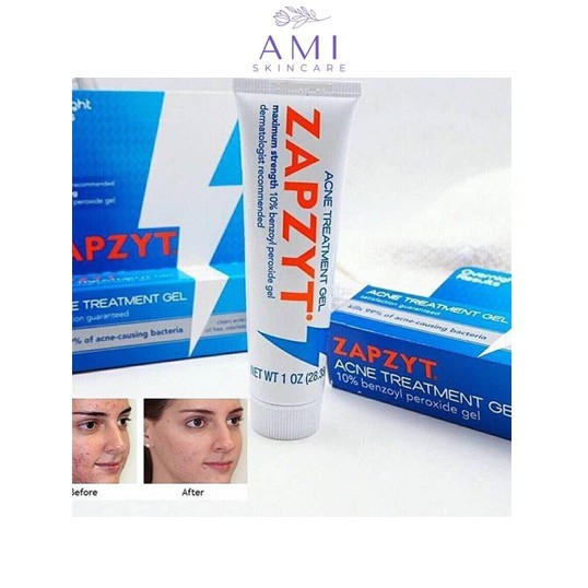 Gel chấm mụn Zapzyt Acne Treatment Gel Clears Acne 28.35gr