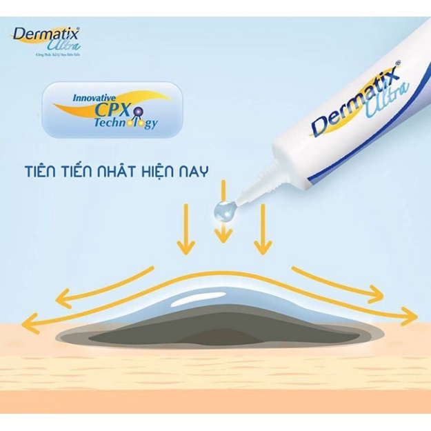 Dermatix ultra cải thiện sẹo - hỗ trợ mờ sẹo và giảm ngứa