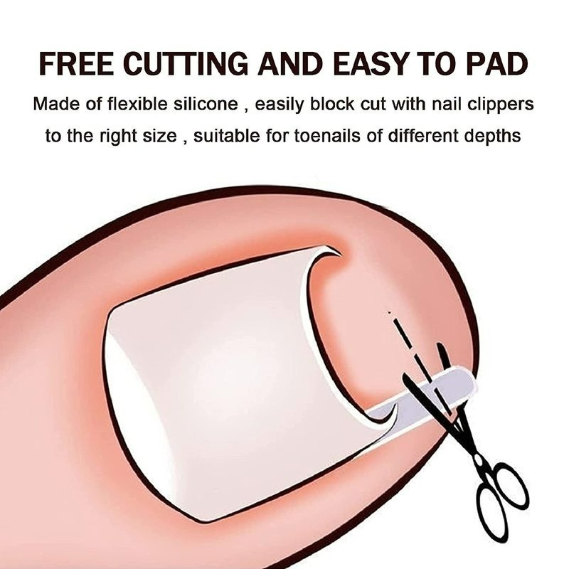 Hộp 1 Hộp Miếng Đệm Co Giãn Chỉnh Sửa Móng Chân Mọc Ngược Trong Suốt Dùng 1 Lần