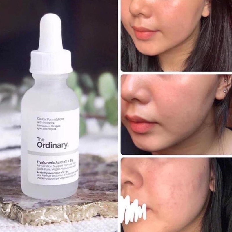 Serum The Ordinary HA-B5 2%+ b5