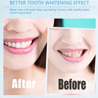 Dây dán trắng răng 5D khử nhiễm làm sạch răng