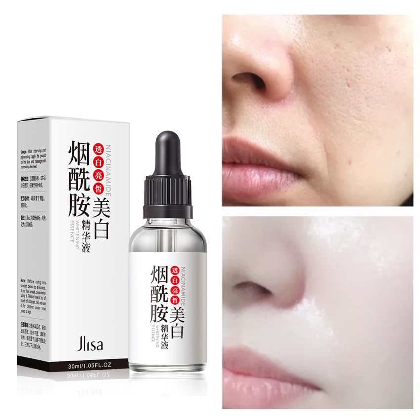 Serum Nicotinamide Dưỡng Ẩm Làm Sáng Da Kiểm Soát Dầu Se Khít Lỗ Chân Lông Chống Lão Hóa