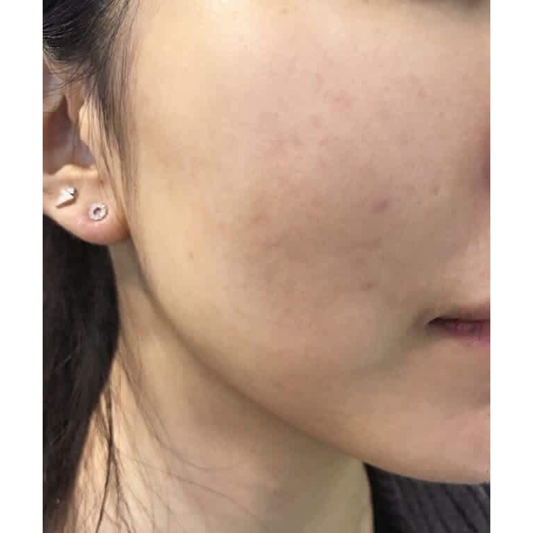 Kem Nền Catrice All Matt Plus Shine Control Make Up 18h