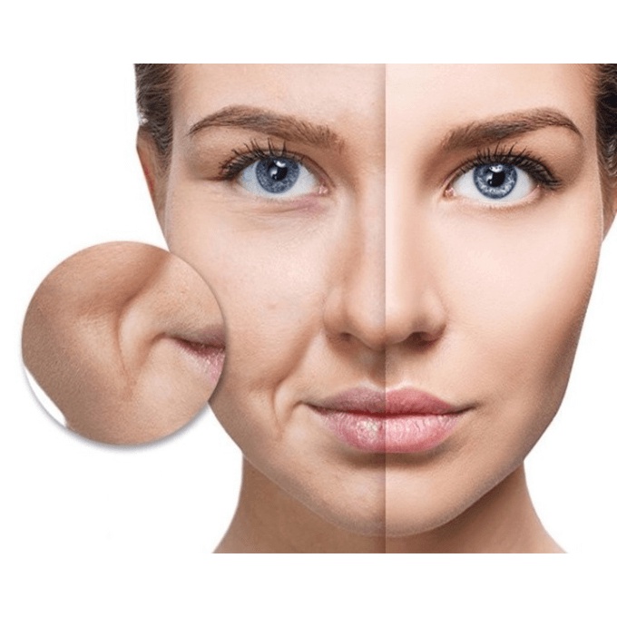 Gói sample siêu huyết thanh xóa nhăn trẻ hóa da hiệu quả sau 4 tuần - OHUI Age Recovery Planning Ampoule