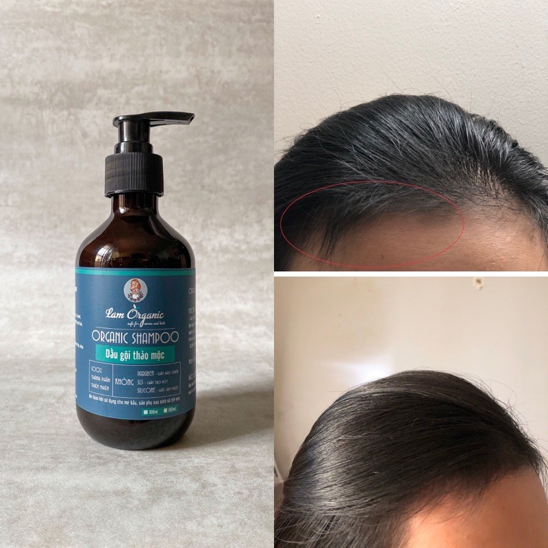 [NGĂN GÀU, NẤM DA ĐẦU, RỤNG TÓC] Dầu gội thảo mộc bưởi bồ kết cô đặc handmade by LAM ORGANIC | BigBuy360 - bigbuy360.vn