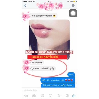 Tinh chất đầy môi, tạo môi trái tim