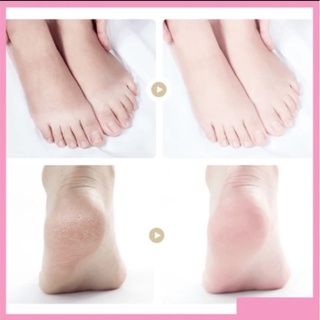 TÚI Ủ CHÂN HẾT NỨT NẺ