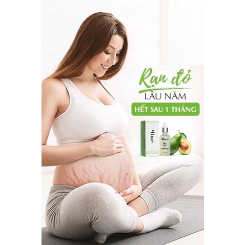 Tinh dầu chống rạn da Bae