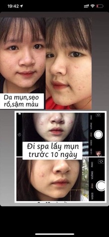 Combo Dược Mĩ Phẩm Vaurora