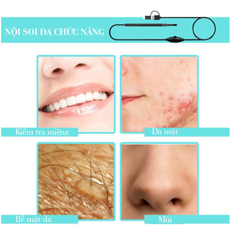 Máy nội soi lấy ráy tai Inskam | Quay – thu ảnh trực tiếp