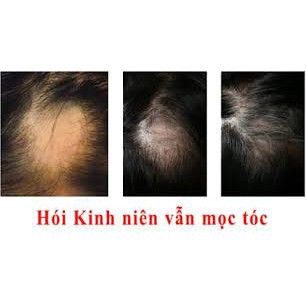 [Rụng tóc] Dầu gội trị rụng tóc - Hàng chính hãng Thu Hương