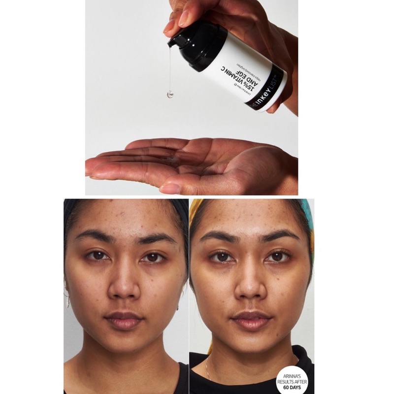 Tinh Chất Trắng Sáng Da Mờ Thâm The Inkey List 15% Vitamin C and EGF Brightening Serum