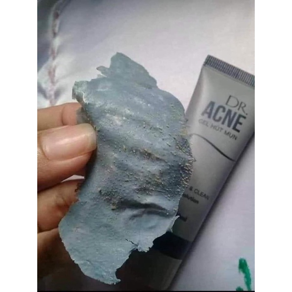 Lột Mụn DRACNE vua hút lột các loại mụn 🤙