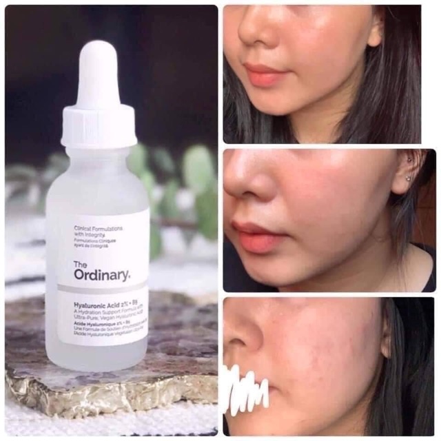 [ HÀNG CÓ SẴN]  Serum The Ordinary Hyaluronic Acid 2%+ B5 cấp nước, phục hồi da 30ml