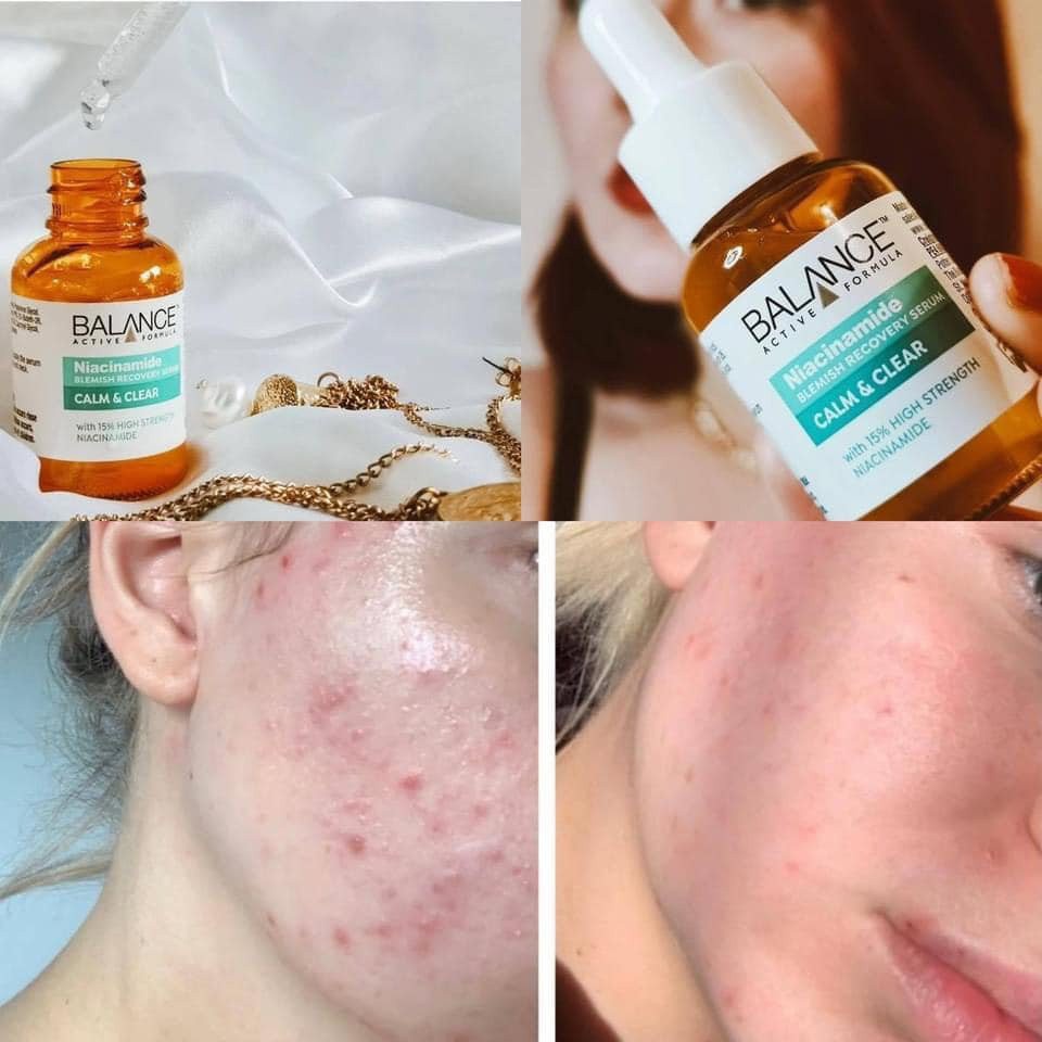 Tinh Chất Cấp Ẩm, Ngừa Mụn, Dưỡng Trắng, Mờ Thâm Balance Active Formula Niacinamide Blemish Recovery Serum 30ml