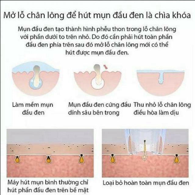 Máy Hút Mụn Spa, Máy Hút Mụn BLACK HEAD DETECTOR Mini Siêu Sạch Mụn Đầu Đen Cầm tay Cao Cấp GD01 (HOT) | BigBuy360 - bigbuy360.vn