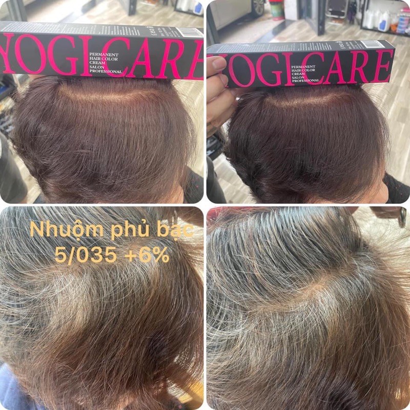 Thuốc Nhuộm tóc phủ bạc Yogi 5/035