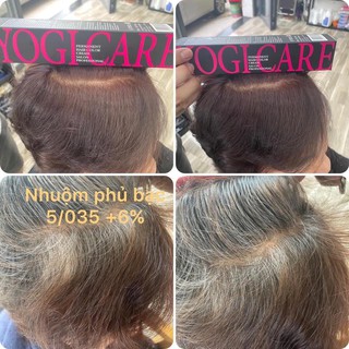 Thuốc Nhuộm tóc phủ bạc Yogi 5/035