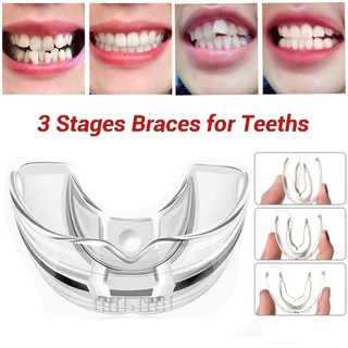 Bộ 3 dụng cụ niềng răng chỉnh nha chuyên dụng cho người lớn