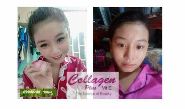 Chuyên  sỉ kem  collagen plus vit  e hàng  chính  hãng hệ  thống Nguyễn  Thanh Tuyền