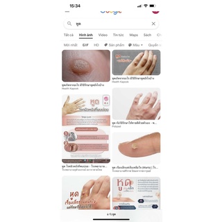 Chấm mụn cơm mụn cóc ConCon Thailand