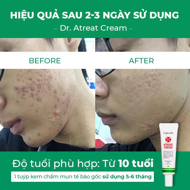 [Mã FMCGMALL -8% đơn 250K] Kem chấm mụn Hàn Quốc Lagivado Ngăn Ngừa Và Phục Hồi Da Mụn Dr. Atreat Cream 30 ml | BigBuy360 - bigbuy360.vn