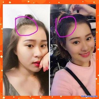 S12 Tinh Dầu Bười Ngăn Rụng Tóc, khiến Dày Tóc Và Giúp Tóc Mọc Nhanh 1