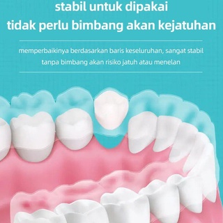 Răng giả niềng răng chất lượng cao