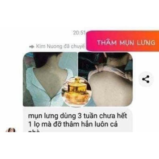BIHO LADI Siêu Dưỡng Thâm 5s  [XÓA THÂM NÁCH, BỤNG Bẹn, Cùi Trỏ ] | BigBuy360 - bigbuy360.vn