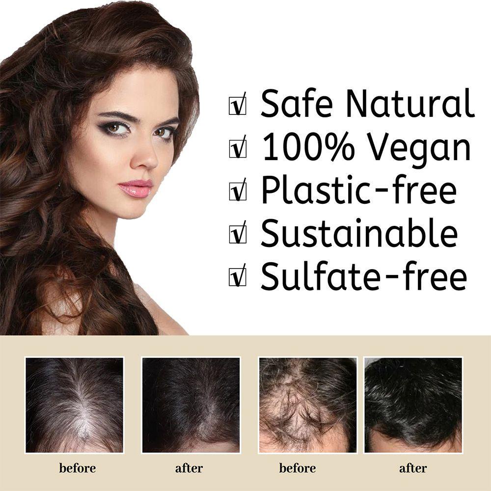 Dầu Gội Đầu Chiết Xuất Gạo Chống Rụng Tóc Dưỡng Ẩm Có Hương Hoa