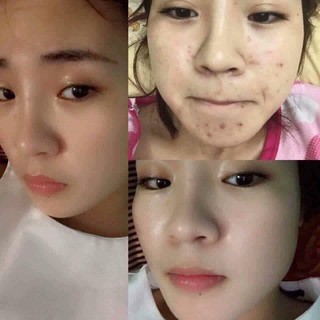 MẶT NẠ DETOX THẢI ĐỘC DA DJ CO2 THERAPY ( 1 Hộp 5 Ống Gel CO2 + 5 Mask)
