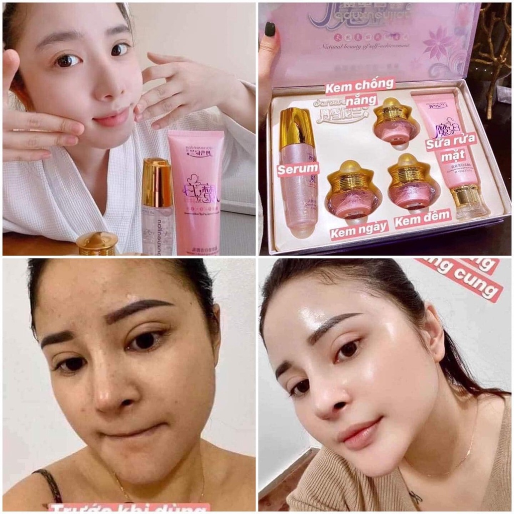 Kem Hoàng Cung Hồng 5 Món Dưỡng Trắng Da Chuyên Sâu Mờ Nám