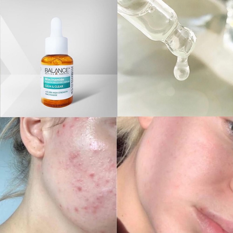 SERUM BALANCE NIACINAMIDE 15% CALM AND CLEAR