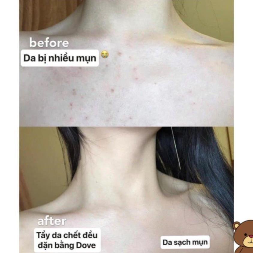 Tẩy da chết body DOVE giúp da mịn màng chiết xuất từ thiên nhiên hũ 50g [ Hàng Chính Hãng ] | BigBuy360 - bigbuy360.vn