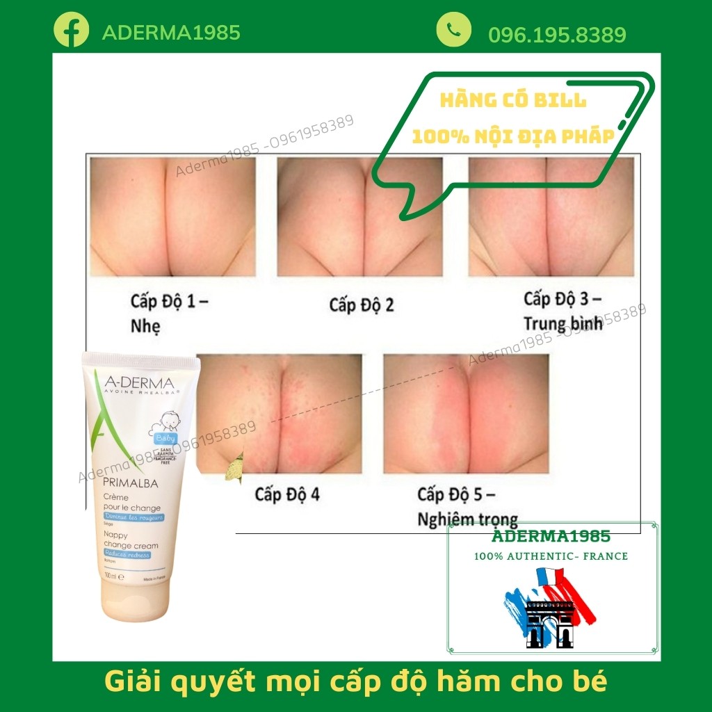 Kem hăm Aderma primalba, kem A-derma Primalba giúp bé hết hăm tã, giúp mông bé thông thoáng, mịn màng.