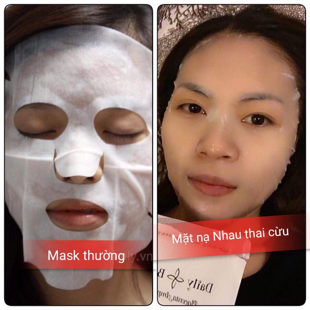 Mặt Nạ Nhau Thai Cừu Daily Beauty Multi Peptide Placenta Mask Hàn Quốc nuôi dưỡng làn da căng mịn, sạch mụn | BigBuy360 - bigbuy360.vn
