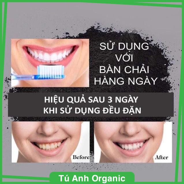 [HÀNG CHÍNH HÃNG] Trắng răng My Smile 70g, làm trắng răng an toàn, cách làm trắng răng hiệu quả