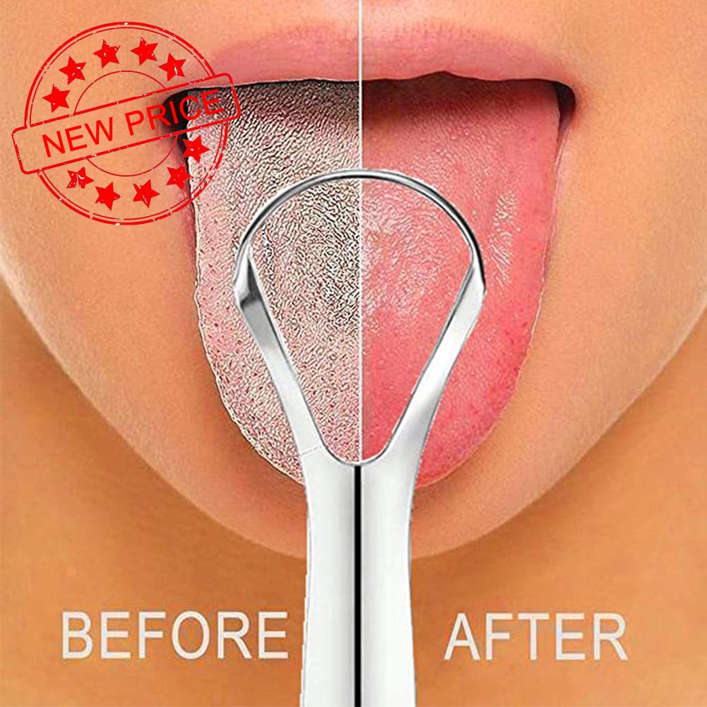 Dụng Cụ Cạo Lưỡi Bằng Thép Không Gỉ Chất Lượng Cao X1A6